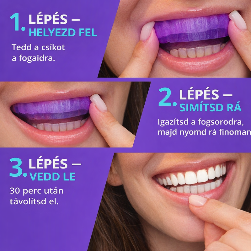 DentaGlow Fogfehérítő csíkok