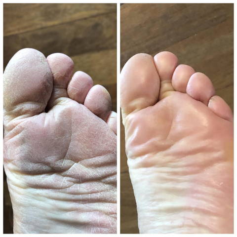 Előtte - utána
