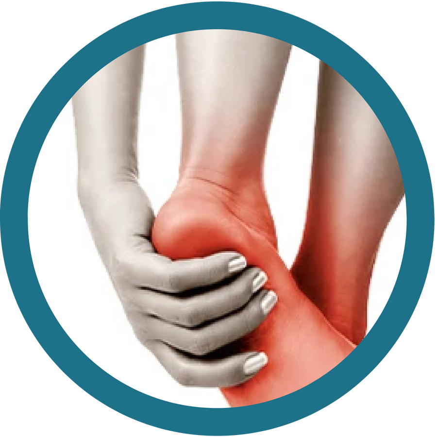 Plantar fasciitis
