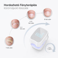 Hordozható Fényterápiás Körömápoló Készülék