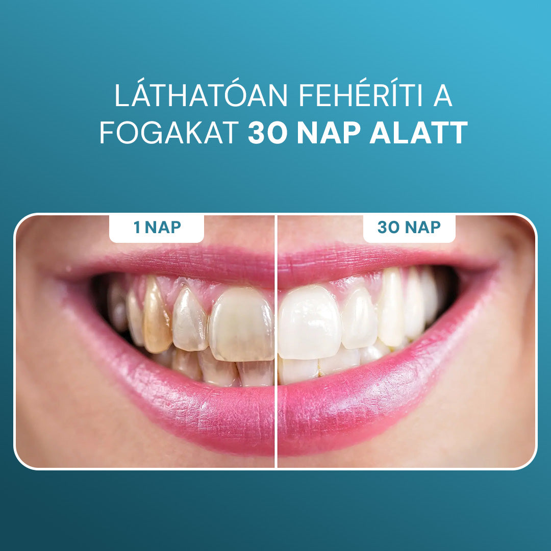 PureWhite Gum Cukormentes Remineralizáló Fogtisztító Rágógumi