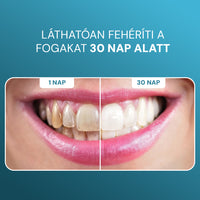 PureWhite Gum Cukormentes Remineralizáló Fogtisztító Rágógumi