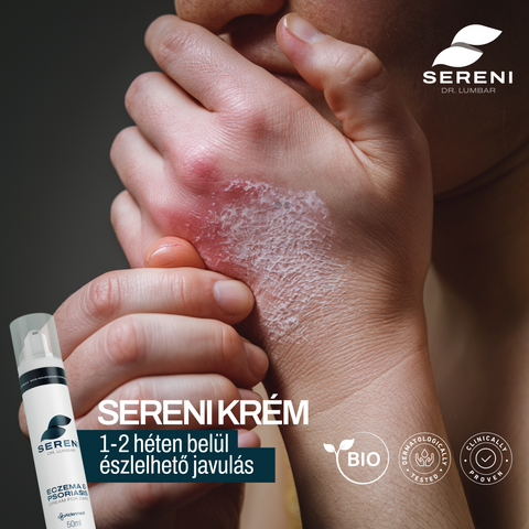 Sereni Pikkelysömör és Ekcéma Krém
