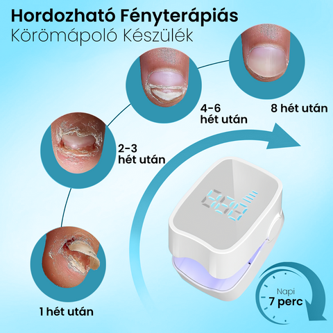Hordozható Fényterápiás Körömápoló Készülék