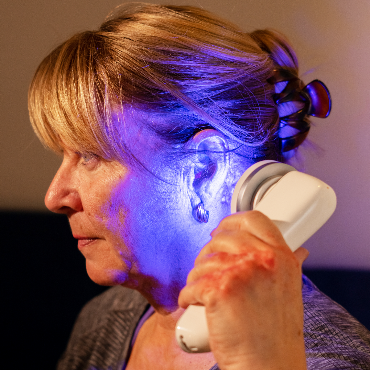 Gyengéd kezelés a bőr mély rétegeinek is az egyedülálló vaporizációs technológiával
