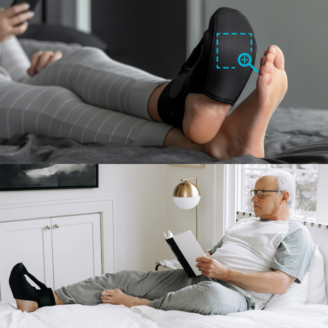 Az éjszakai sínek hatékonynak bizonyultak a plantar fasciitis kezelésére 
