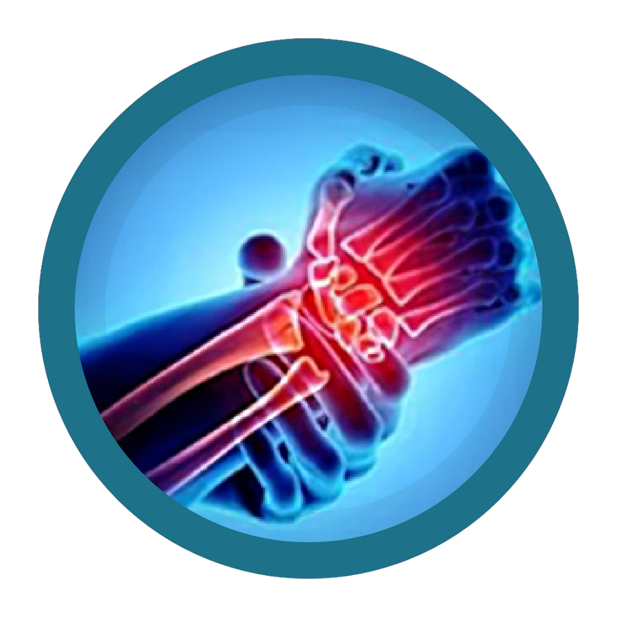 Nyáktömlőgyulladás (bursitis)