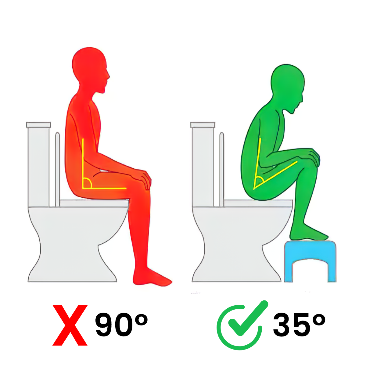 Tudta, hogy a modern WC-használat gátolja teste természetes működését?