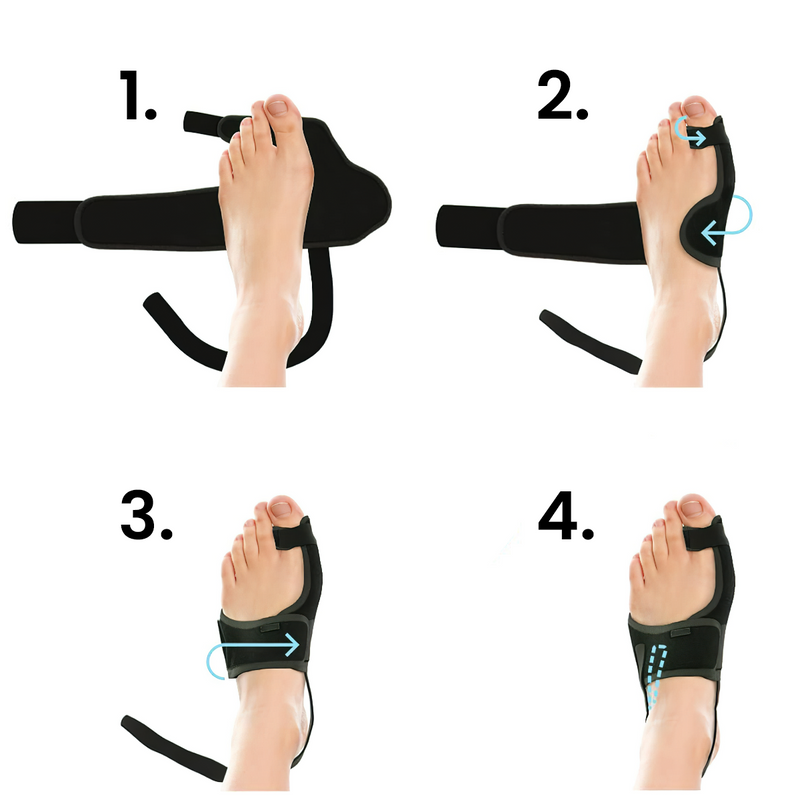 ComfyToes Nappali és Éjszakai Lábujjtámasz Szett