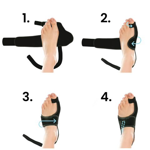 ComfyToes Nappali és Éjszakai Lábujjkiegyenesítő és Bütyök Korrektor Szett