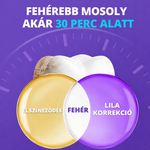 DentaGlow Fogfehérítő csíkok