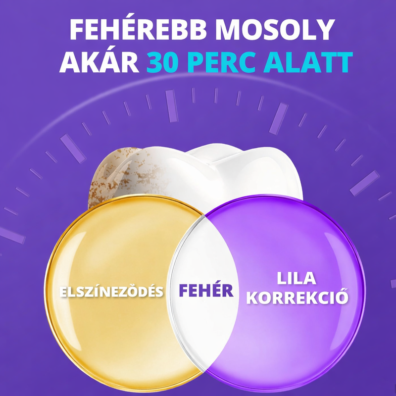 DentaGlow Fogfehérítő csíkok