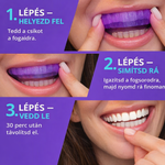 DentaGlow Fogfehérítő csíkok