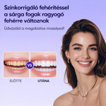 DentaGlow Fogfehérítő csíkok