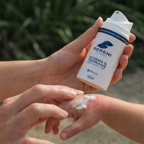 Sereni Pikkelysömör és Ekcéma Krém